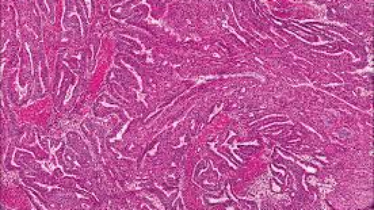 Histpathology